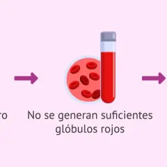 Cantidad de hierro insuficiente lleva a pocos glóbulos rojos y cansancio. Esto puede afectar la menstruación.